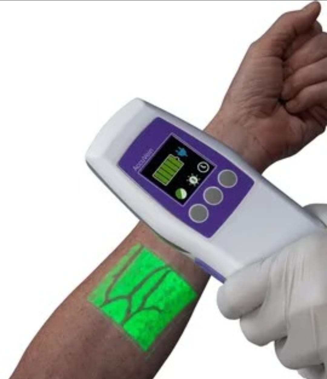 Vein Finder